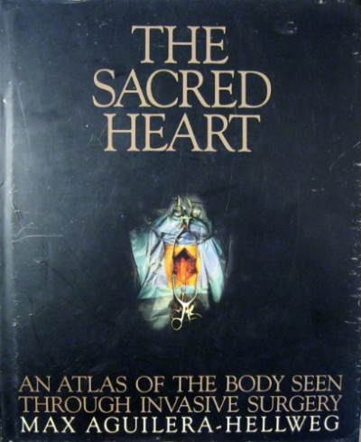 The Sacred Heart: An Atlas of the Body Seen Through Invasive Surgery
