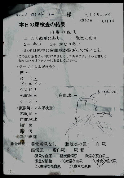 Japanese Doctor's pencil rendering of my Penis.